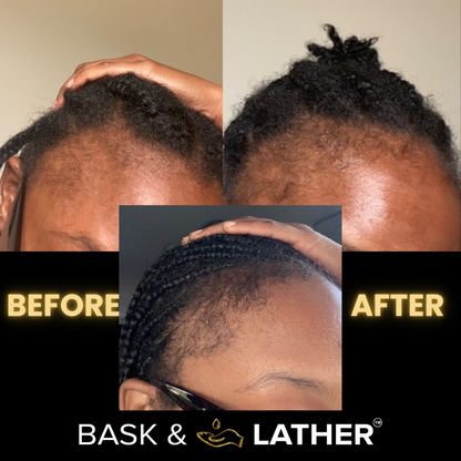 JUMBO Scalp Stimulator